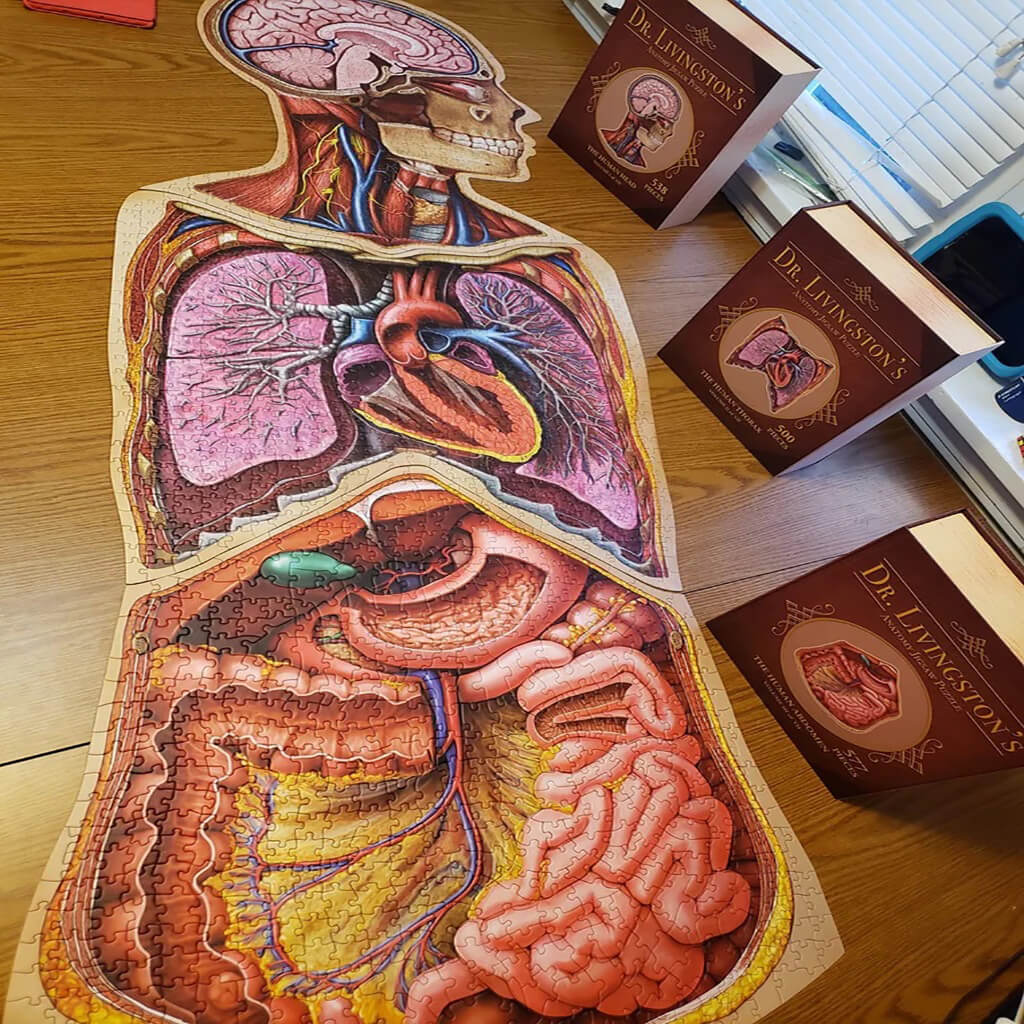 [Grade A] Dr. Livingston's Anatomy Jigsaw Puzzle: The Human Abdomen